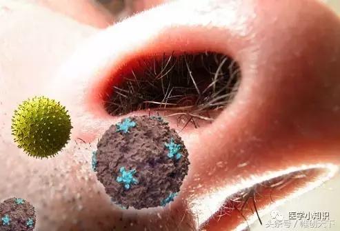 鼻窦炎图片和治疗方法,副鼻窦炎最好的治疗方法