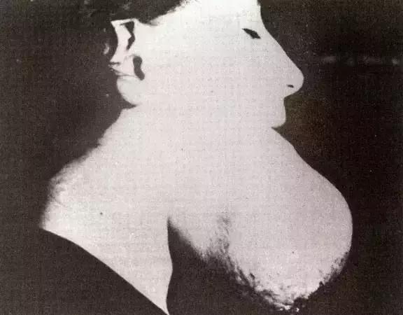 这种物质曾被当作保健成分,受害者的遗骨因此发光上千年