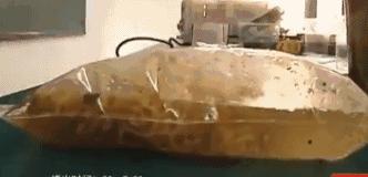 25岁男孩吃外卖吃出胃癌,长期吃泡面会胃穿孔吗