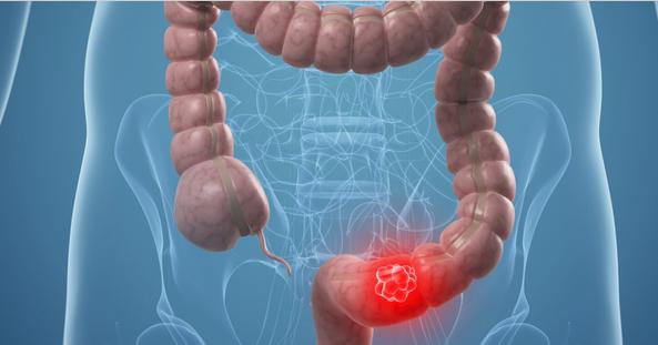 30到40岁体检必须做哪些检查,人过40注意事项