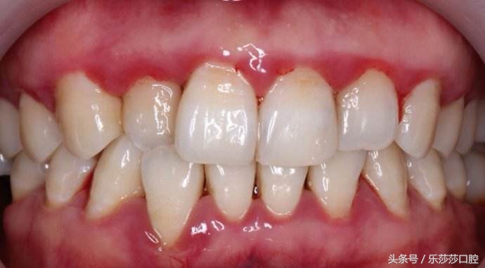 牙疼到底算什么样的一种病,牙疼到底是不是病