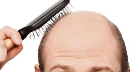 治疗白发和脱发的有效药方和方法,脱发可以吃米诺地尔吗