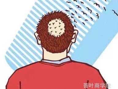 这些头发养护的误区你中过几个,这些脱发知识你一定要知道