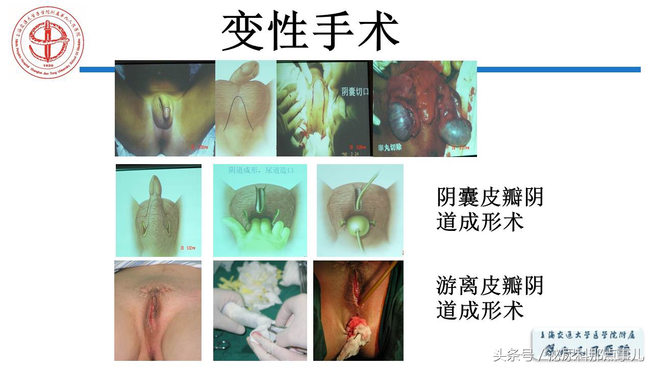 泌尿男科王忠教授,泌尿外科专家王忠教授