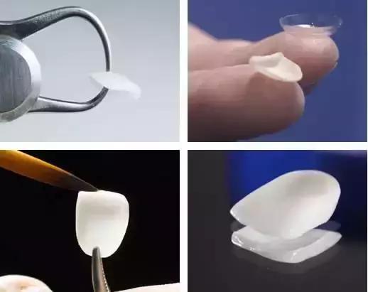 关于牙齿美白你需要知道的哪些事,牙齿美白方法干货分享