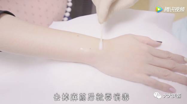 视频｜激光点痣，光洁皮肤不做小斑点汪汪