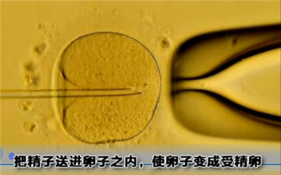 试管婴儿过程痛苦么,试管婴儿到底有多遭罪