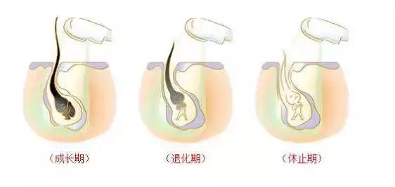 不要轻易的尝试脱毛,脱毛时大家都在做什么