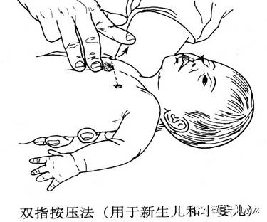 宝宝被呛到急救方法,宝宝被呛到怎么办如何急救