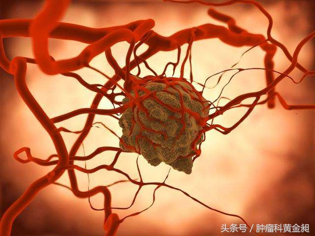 介入栓塞治疗和化疗哪个效果好,肺癌介入栓塞化疗对人的危害