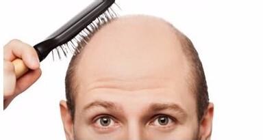 年轻人头顶脱发能恢复是真的吗,为什么现在的人脱发掉发严重