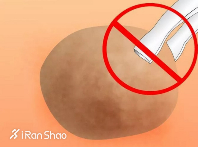 怎么分辨水泡是什么原因引起的,大水泡的症状及治疗方法