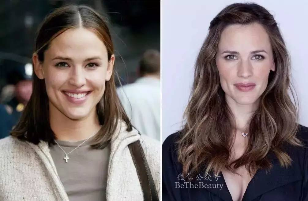 鎬庝箞璁╄劯鍨嬪彉寰楀ソ鐪嬪皬鍦嗚劯,濡備綍璁╄劯鍨嬪彉鎴愭祦鐣呭皬鍦嗚劯