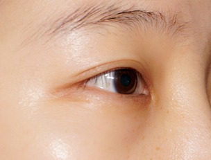 睫毛很浓密眉毛少的女生,睫毛短稀少的美女看过来