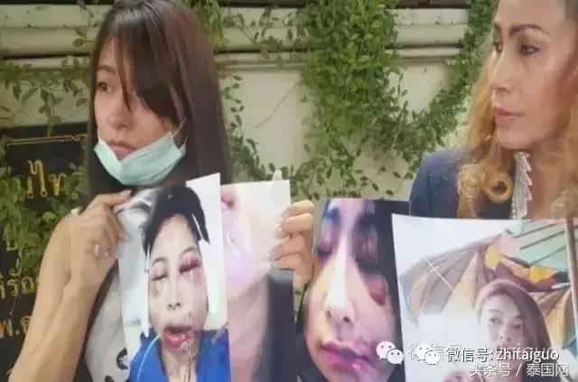 泰国整容和韩国整容哪个更好,泰国整容和韩国整容区别