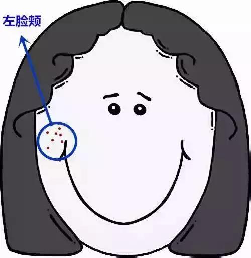 脸上长个痘痘挤出来白色的臭臭的,胳膊上有痘痘挤出来是白色条状物