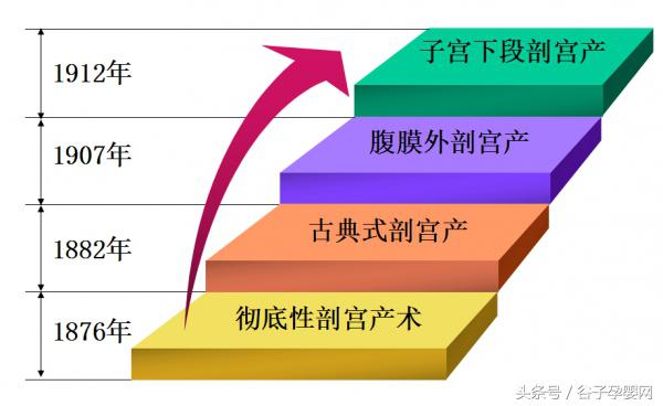顺产自然分娩知识,自然分娩过程分为几个产程