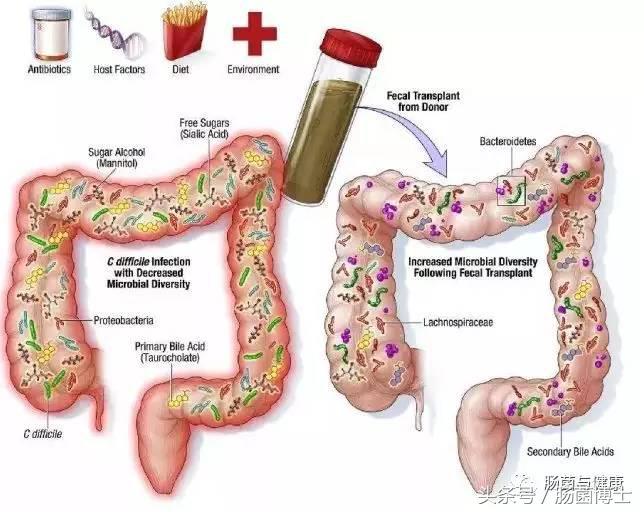 益生菌有望治疗自闭症?