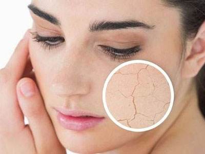 肌肤恢复润泽,皮肤水润不干燥怎么补