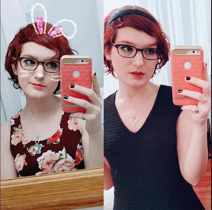 厉害了word的雌性激素，竟然还能拯救大叔的秃顶