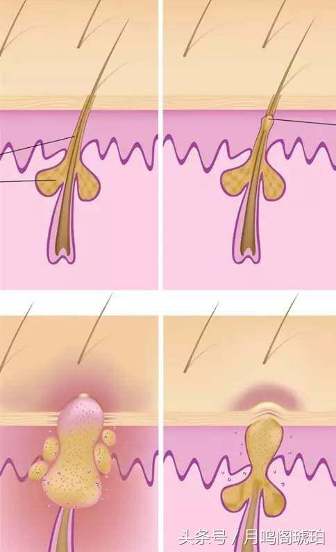 一块香皂的真正魅力,琥珀皂手工皂