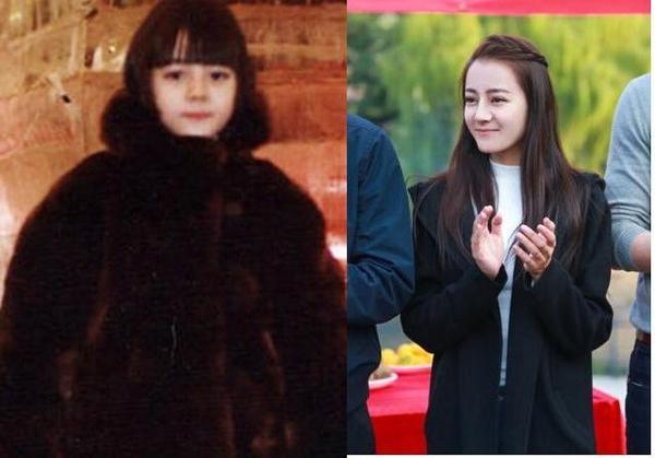 车晓鼻子现在好了吗,车晓整鼻子了吗