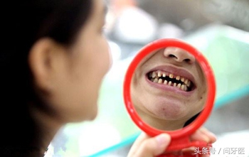 美容冠矫正后悔吗,美容冠矫正牙不齐视频