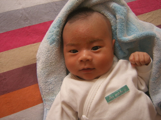 新生儿头垢需要处理吗,新生儿头痂怎么洗