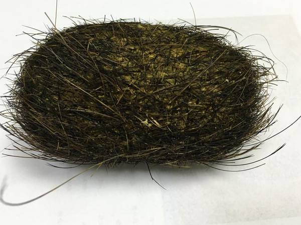 男子杀猪竟收获猪宝,男子杀猪获得猪宝