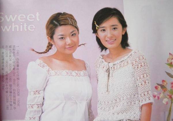 车晓鼻子现在好了吗,车晓整鼻子了吗