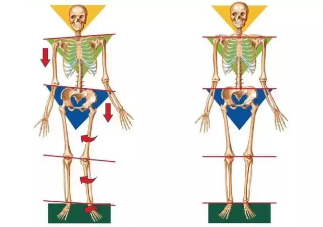 八字脚跑步对身体有什么影响,跑步怎么纠正外八字脚