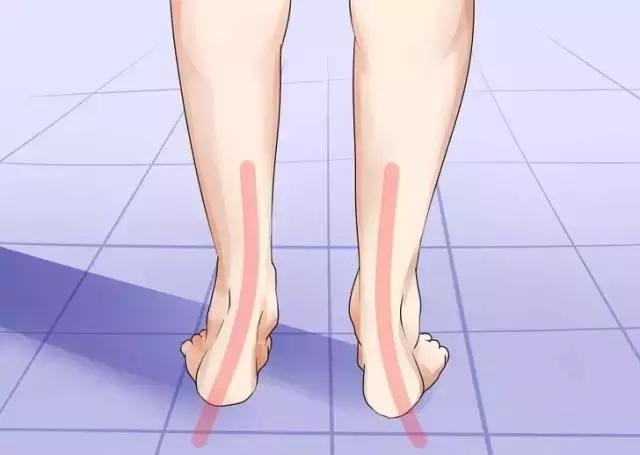 八字脚跑步对身体有什么影响,跑步怎么纠正外八字脚