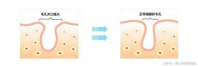 毛孔问题解决方法视频,烫伤后毛孔变大会恢复正常吗