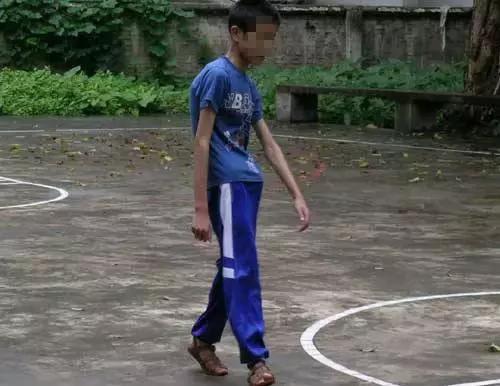 八字脚对跑步有影响吗,跑步时八字脚产生原因及纠正方法