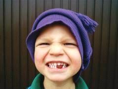 牙齿快掉了老师流血了怎么办,牙齿掉了一直流血怎么才能止住血