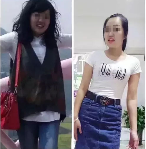 埋线减肥后怎样才能不反弹,埋线减肥肚子反而更大了