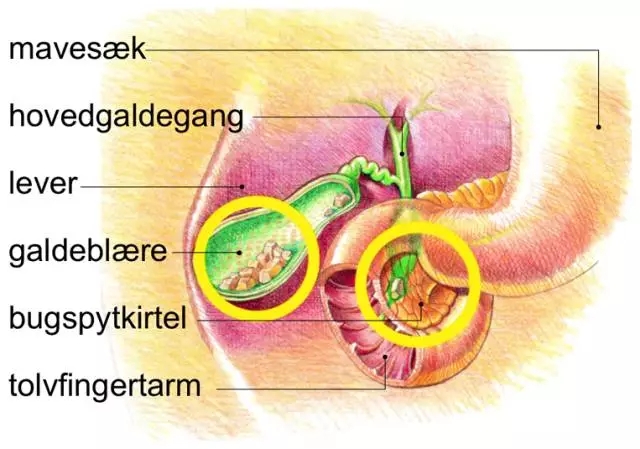 军队体检胆囊息肉标准,征兵体检胆囊息肉的标准