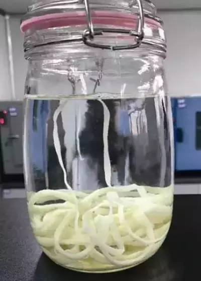 男子的肚子里养个寄生虫,男子肚子里有很多虫子