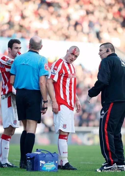 头球会伤头部吗,头球影响球员大脑或致记忆衰退