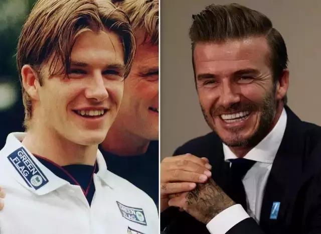 有多少明星整了鼻子,整过的明星有哪些