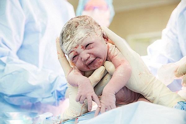 护理剖腹产月嫂都需要做哪些事情,剖腹产刀口愈合后怎么护理长得好