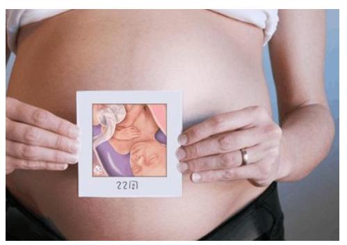 一分钟看懂b超图,一分钟看b超