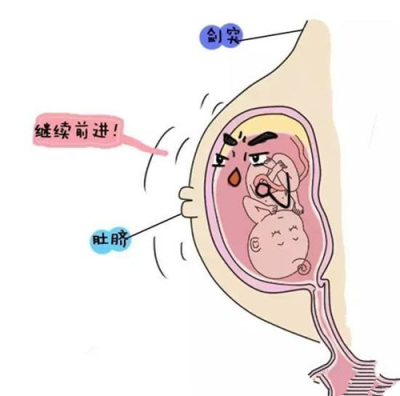 瓜熟蒂落会有时,孕妈遇到这些症状莫惊慌!