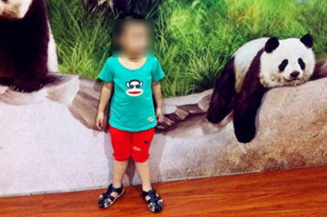 婴儿x型腿怎么矫正,x型腿怎么矫正最快方法