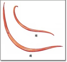 宝宝肚子里有虫子症状图片,小孩肚子里长虫子是什么原因