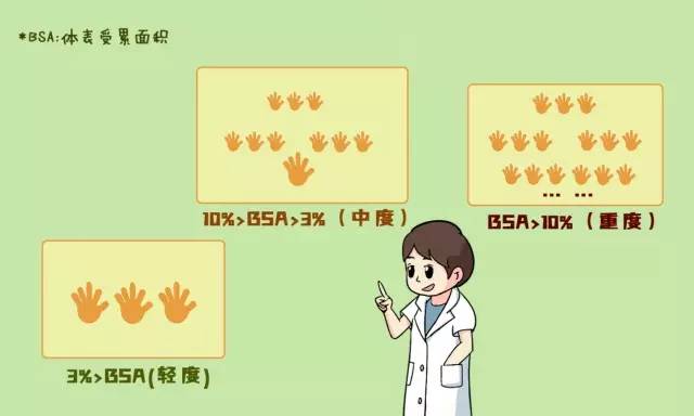 银屑病的日常护理与注意事项,银屑病患者饮食注意事项有哪些