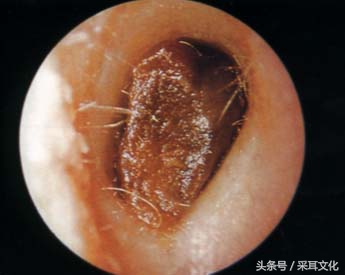 你以为采耳很简单么,你以为的采耳和现实中的菜