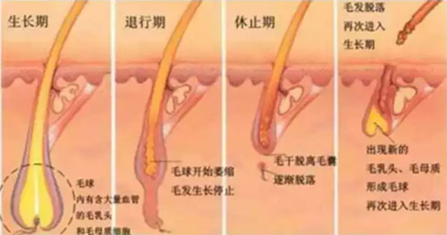 激光脱毛后的真实感受,激光脱毛一年后的真实感受