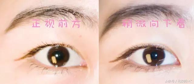 真实贴双眼皮贴,单眼皮怎么贴第二天变双眼皮