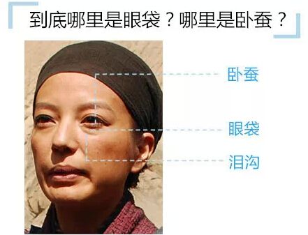 眼袋的形成原因及解决方法,眼袋是怎么形成的去除眼袋的方法